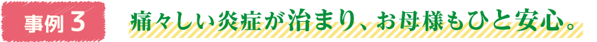 事例3　痛々しい炎症が治まり、お母様もひと安心。