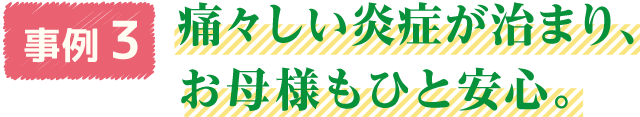 事例3　痛々しい炎症が治まり、お母様もひと安心。